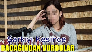 Şarkıyı Kesince Bacağından Vurdular