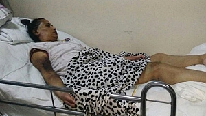  Kilolardan Kurtulmak İçin Ameliyat Oldu, Felç Geçirdi