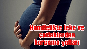 Hamilelikte leke ve çatlaklardan korunma yolları