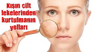 Kışın cilt lekelerinden kurtulmanın yolları
