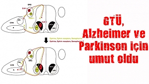 GTÜ, Alzheimer ve Parkinson için umut oldu