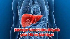 Karaciğer kanserinden dünyada yılda 740 bin kişi ölüyor