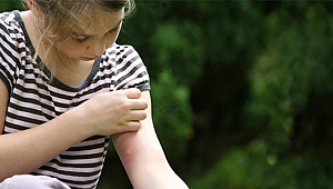 Sivrisinekler neden bazılarını daha çok ısırır