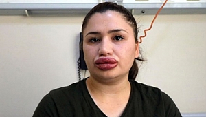 Cezaevinden kaçan sahte estetikçi yakalandı