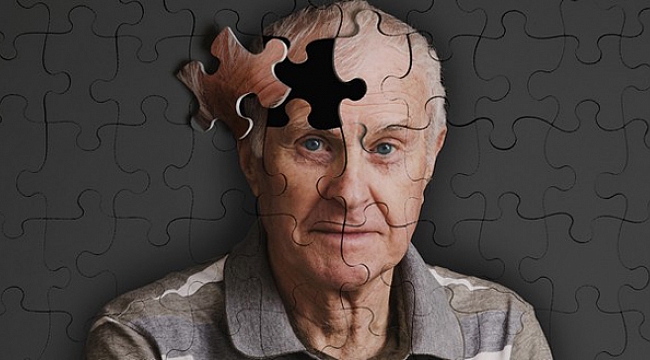 Alzheimer hastalarına elektrikli tedavi