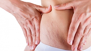 Çatlakların sebebi kafein olabilir