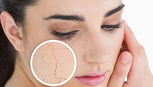 Kuru ciltler için bakım ipuçları