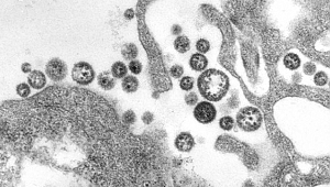 Lassa Humması'na aşı bulunamıyor