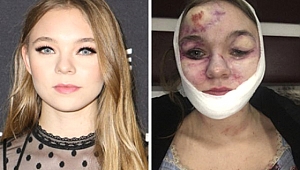 Sette korkunç kaza!