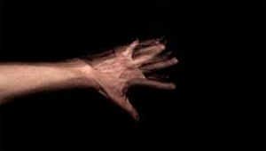 Yabancı el sendromu nedir