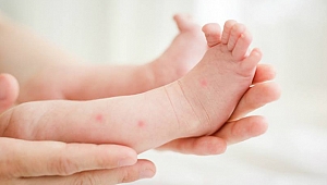 Bebeğinizi sinek ısırıklarından lavanta yağıyla koruyun