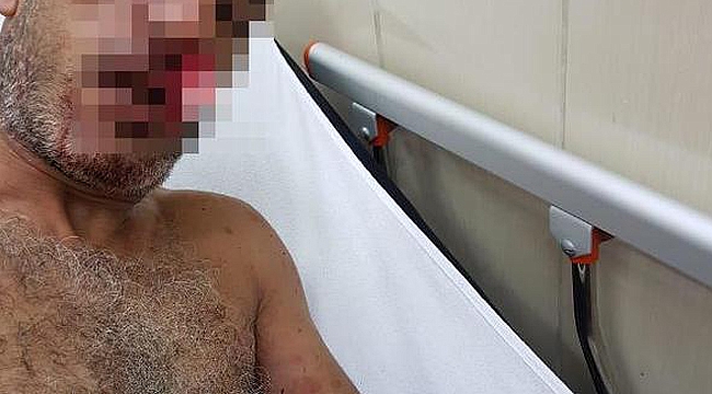 Eski ortağını bıçakladı