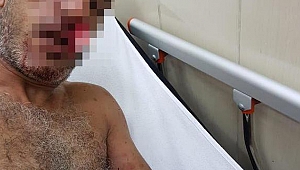 Eski ortağını bıçakladı