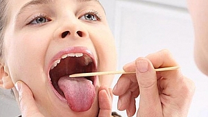 Bademcik taşı nedir?