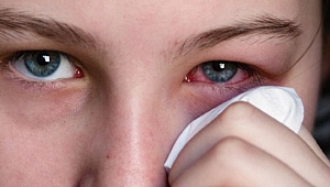 Göz enfeksiyonu salgınına dikkat