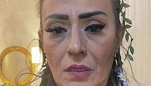 Tilbe: Benim tek estetiğim kaşlarımı almam
