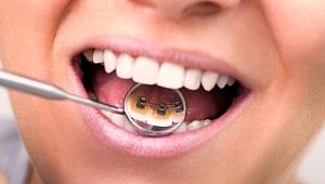 Her yaşta özgürce gülümseyin