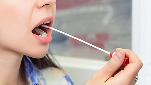 Tükürük bezlerinde taş oluşumuna dikkat!