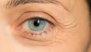 Kataraktın tedavi yöntemleri nedir?