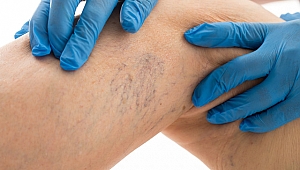 Sıcak havalarda varislere iyi gelecek öneriler