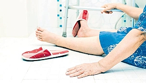 Kalça kırıkları tedavisinde cerrahi yaklaşım