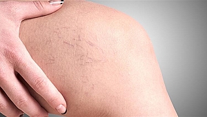 Varis problemi yaşayanlara uzun yol tavsiyeleri