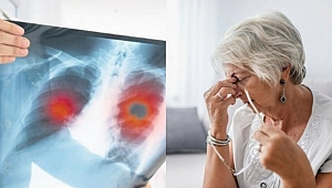 KOAH görülme sıklığı kadınlarda artıyor