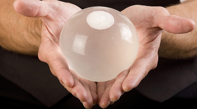 Mide balonunun avantajları