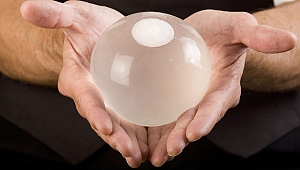 Mide balonunun avantajları