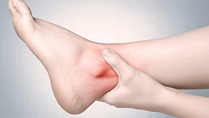 Ödeme karşı alınabilecek basit önlemler