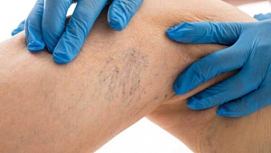 Soğuk suyla masaj yapın!