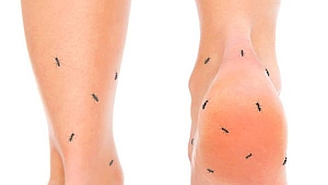 Vücutta karıncalanma neden olur?