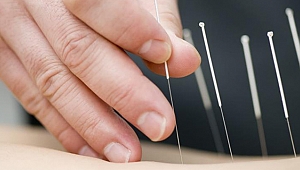 Akupunktur ile zayıflama mümkün mü?