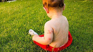 Böcek ısırması ne zaman tehlikelidir?