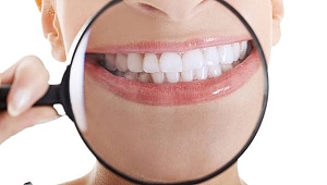 Bu işlemler dişlerinize zarar verebilir