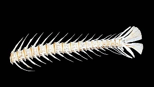 Kireçlenme için neler yapılabilir?