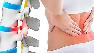 Çözümü bu kadar basitmiş