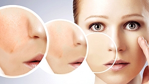 Ciltteki sarkmalar ve lekeler tedavi edilebilir