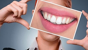 Diş boşluklarını tek seansta kapatmak mümkün