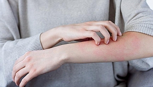 Kış aylarında uyuza dikkat!