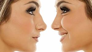 Burun estetiğinde dikkat edilen noktalar