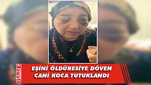 Körfez’de cani koca, karısını bu hale getirdi