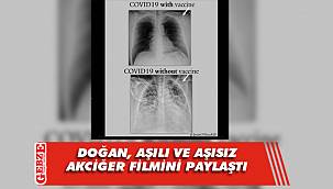 Ulaş Doğan, bu kez akciğer filmiyle uyardı