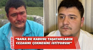 Uslu'nun yüzündeki iz bir ömür boyu kalıcı
