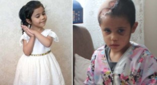 Minik Asiye her geçen gün iyileşiyor