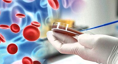 ‘Sepsis’e karşı 10 etkili önlem! 