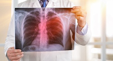 Yaşam kalitesini arttırarak akciğerlerinizi koruyun!