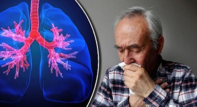 Kış aylarında belirginleşen öksürük KOAH belirtisi olabilir