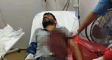 Sayaç okuyan Sepaş personeline köpek saldırdı!
