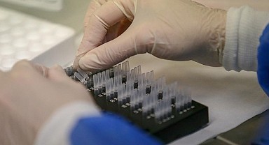Türkiye'de hepatit görülme sıklığı belirgin oranda azaldı